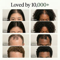 The Korean Scalp Revival Bar 6